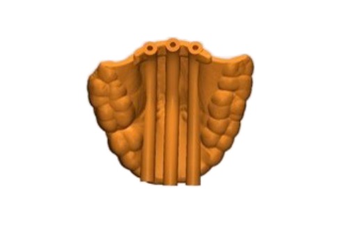 Rendering 3D di brachiterapia con elementi in stampa 3D